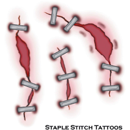 Tattoo Staple Stitch Fx