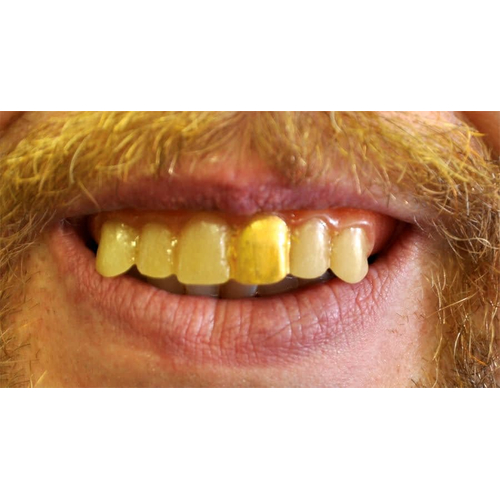 Teeth Glow Gold Miner